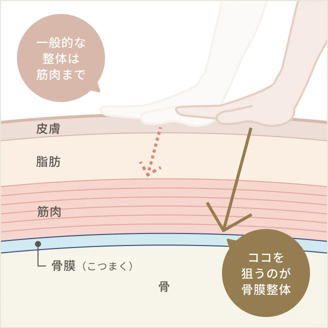 一般整体との違い図解